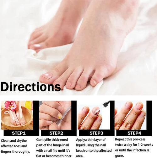 Fungal Nail Treatment Oil